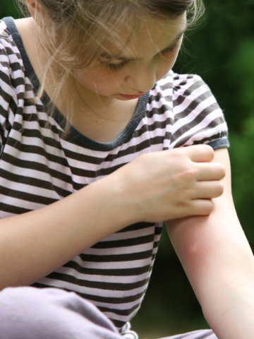 The 5 Best Products To Help With Kids Bug Bites