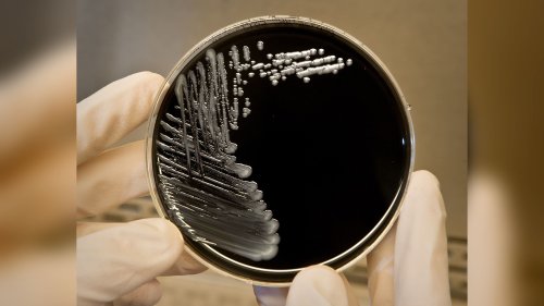 NYC Legionnaire’s outbreak kills 1, Health Department says