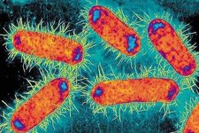 超级恶菌或已出现:“最后抗生素防线”对其无效