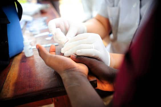 Giornata Mondiale Aids, fa meno paura ma la pandemia non è sconfitta