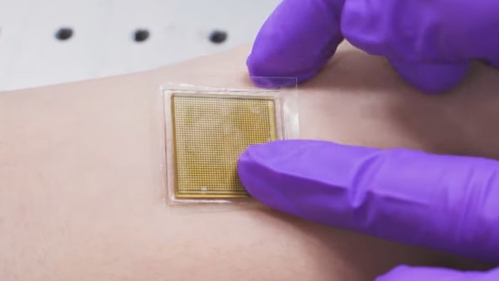 This Skin-Sticking Ultrasound Patch Is Like A Tricorder Band-Aid