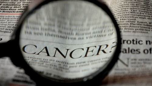 Les hommes sont plus exposés au cancer que les femmes en raison de différences biologiques