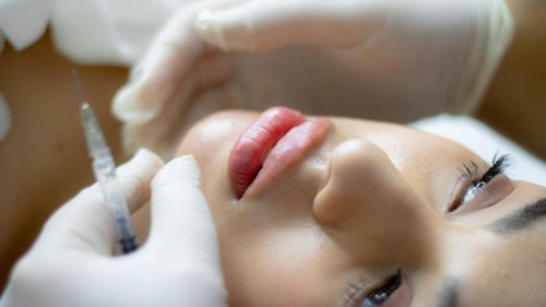 «Je n'arrêterai jamais»: en Chine, les opérations de chirurgie esthétique explosent, même chez les ados