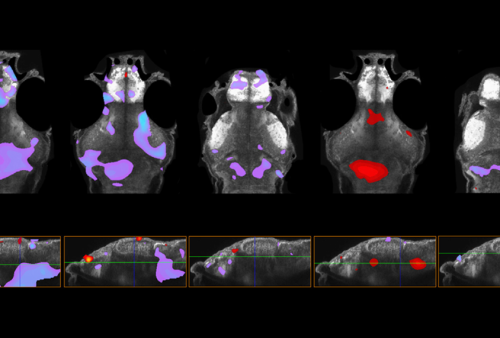 Autism-related genes converge on microglia and dopamine in zebrafish