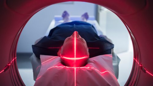 Moderne Krebstherapien: Gezielter Angriff!