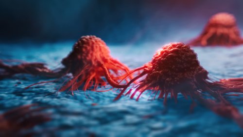 Krebsdiagnostik: Zuckermoleküle in Blut und Urin verraten Tumorerkrankung