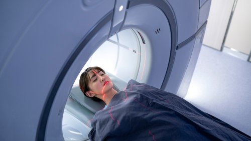 Bildgebung: MRT-Hirnscanner verzerrt die Wahrnehmung