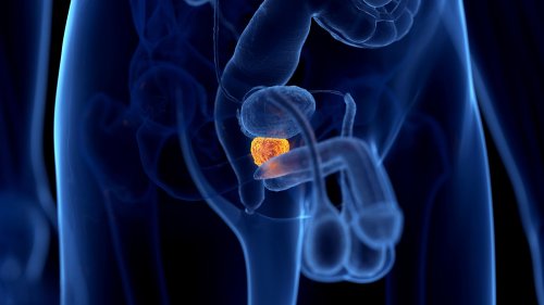 Mediziner planen Änderungen beim Prostatakrebs-Screening