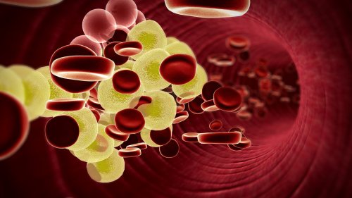 Aus Forschung wird Gesundheit: Was kann man bei angeborenen hohen Cholesterinwerten tun?