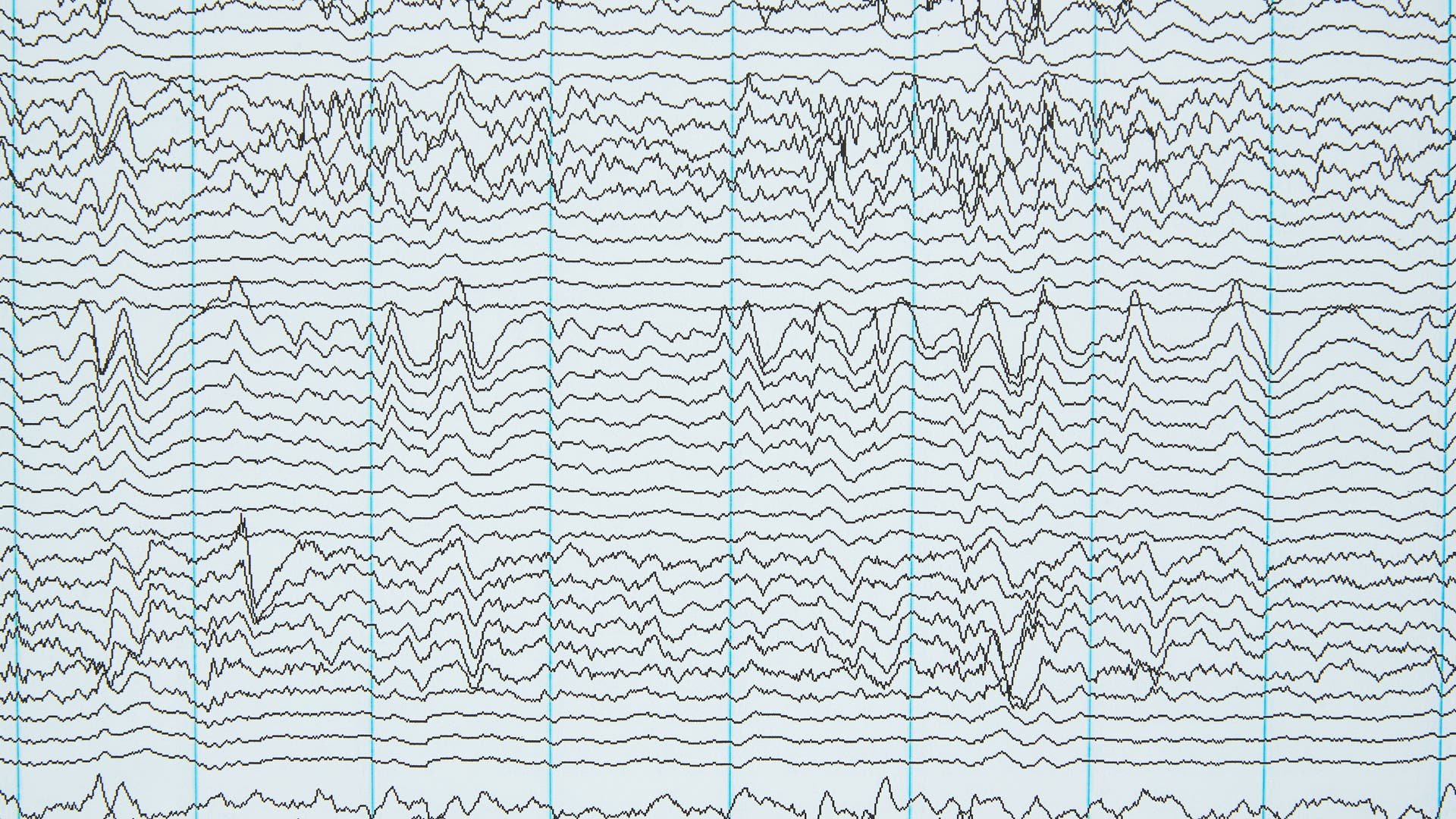Deep Learning: Kann man Sprache aus dem Gehirn »auslesen«?