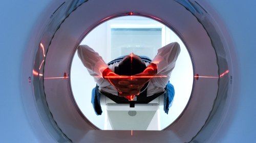 Eignet sich ein Ganzkörper-MRT zur Krebsfrüherkennung?