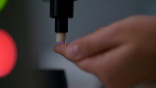 Neue Behandlungsmethode: Wie kaltes Plasma alte Wunden heilt