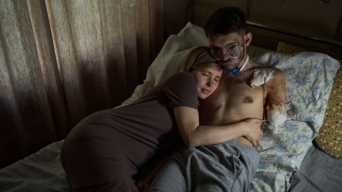 A Ukrainian Couple Scarred by War: "I'm Alive and That’s The Most Important Thing"