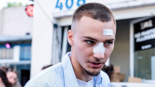 »Unprofessionelles Verhalten« – Lemperle bittet um Entschuldigung 