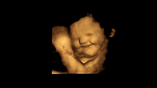 Ultraschallbilder belegen: Babys im Mutterleib lächeln, wenn sie etwas Leckeres schmecken