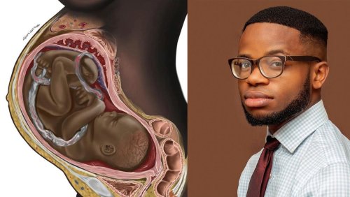 Diskriminierende Darstellungen: Wie ein junger Nigerianer die Medizinbücher der Welt revolutionieren will