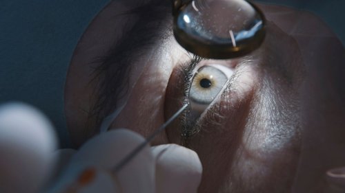 Augenarzt operierte trotz Parkinson – Berufsverbot und Bewährungsstrafe 