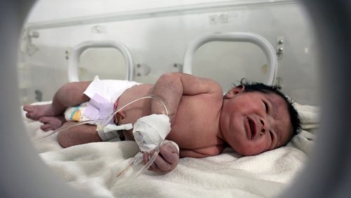 3175 Gramm schwer, zwei Prellungen: Baby überlebt unter Trümmern – und ist durch Nabelschnur mit toter Mutter verbunden