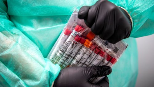 +++ Corona-News +++: RKI meldet 1548 Neuinfektionen, Sieben-Tage-Inzidenz steigt weiter
