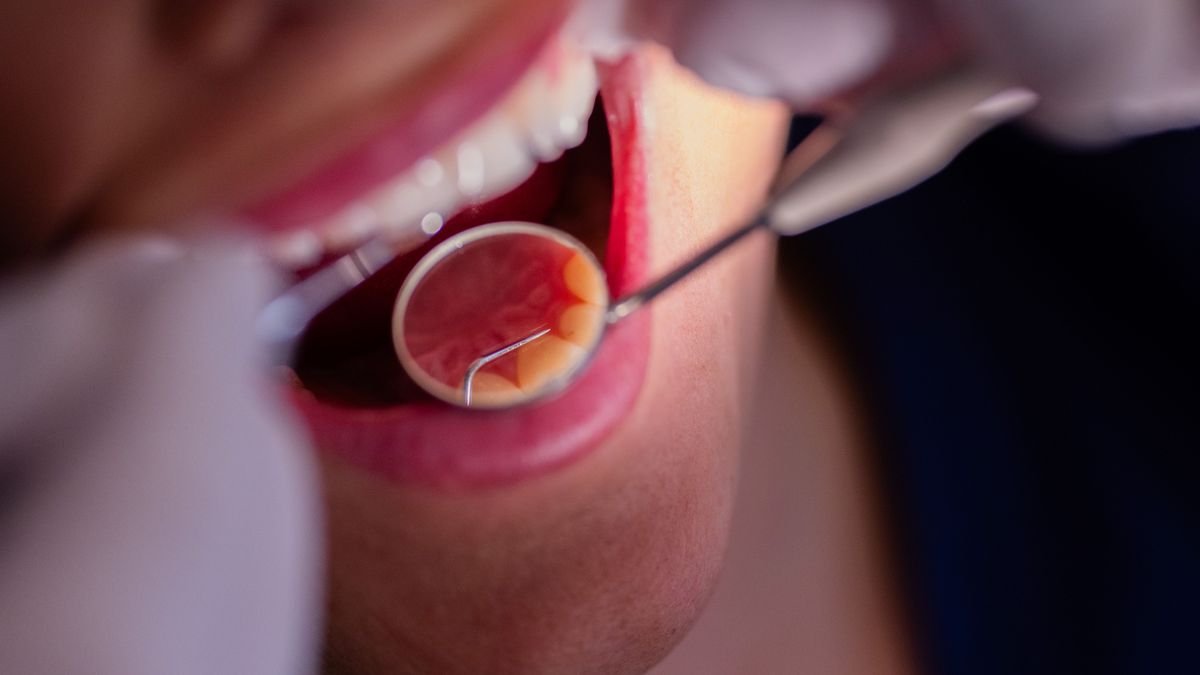 Aktuelle Studie zur Zahngesundheit: Immer mehr Deutsche sind kariesfrei