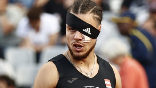 Französische Leichtathletik-Meisterschaften: Hürdenläufer Happio wird vor Finale verprügelt und läuft mit Augenverletzung zum Sieg
