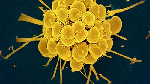 Neu entwickeltes Antibiotikum wirkt gegen resistente Tripper-Erreger 