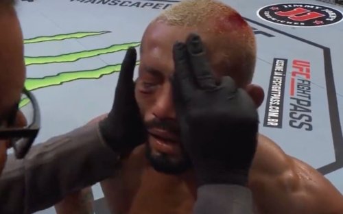 What happened to Deiveson Figueiredo's eye against Brandon Moreno? Controversial injury that cost 'Deus da Guerra' his UFC title