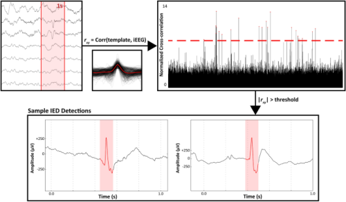 [ARTICLE] Musical components important for the Mozart K448 effect in epilepsy – Full Text