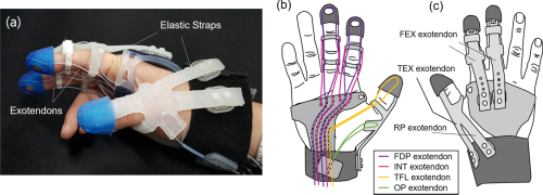[ARTICLE] Increasing motor cortex activation during grasping via novel robotic mirror hand therapy: a pilot fNIRS study – Full Text
