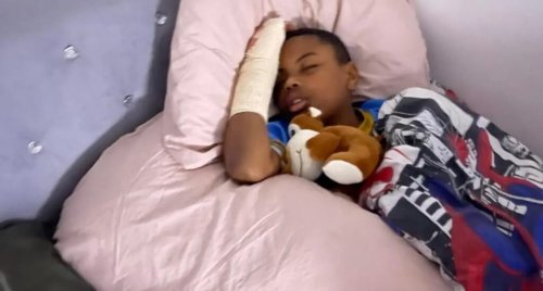 11-Year-Old Boy Gets Finger Amputated After Escaping Racist School Bullies