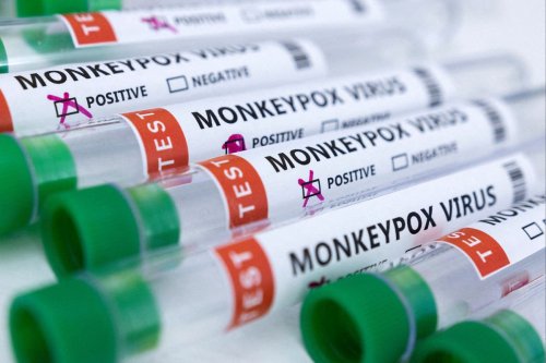Monkeypox: Officials urge continued vigilance as confirmed cases increase