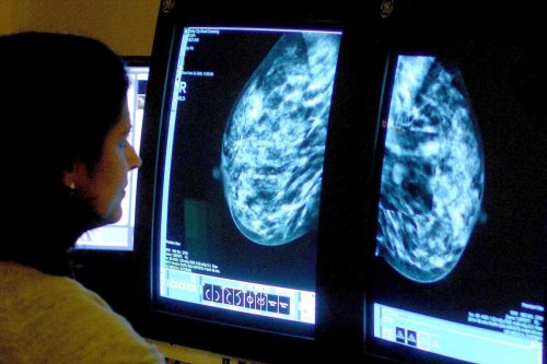 Scientists hail ‘landmark moment’ in the treatment of advanced breast cancer