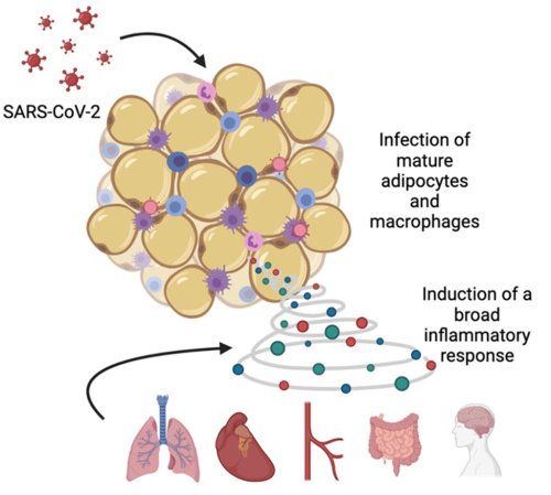 Stanford Medicine study: SARS-CoV-2 infects fat tissue, creates inflammatory storm cloud