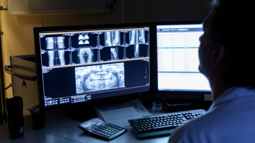 Radiology captures the tension between AI's potential and concern for patients