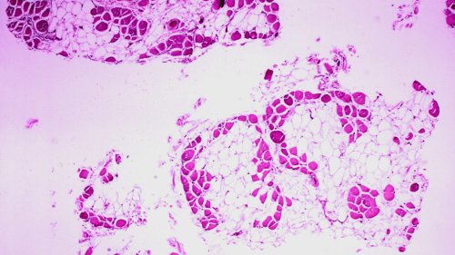 Day 1 at ASGCT: Missing scientists, a gene editing failure, and a gene editing first