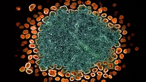 ViiV expands licensing deal for its HIV drug in low-income countries