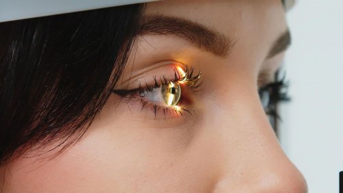 "Ich sah eine Werbung am Bus: Nie wieder Brille. Das klang verführerisch"