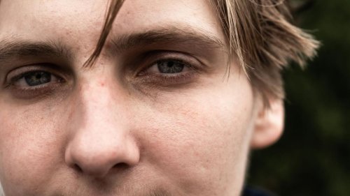 "Ich habe die Zombie-Droge überlebt. Das können nicht viele sagen"