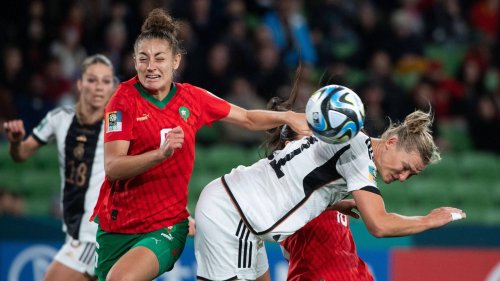 Gehirnerschütterungen im Sport: Warum "Concussion Spotter" gerade im Frauen-Fußball so nötig sind