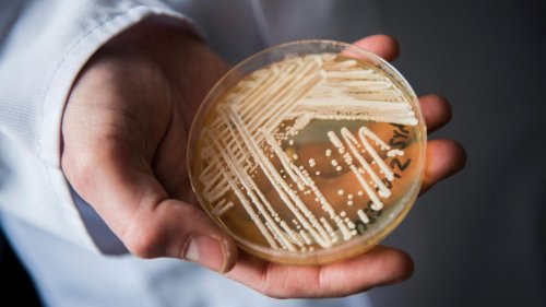 Infektionsbiologe über krank machenden Hefepilz: "Noch haben wir die Möglichkeit, seine Ausbreitung zu verlangsamen"