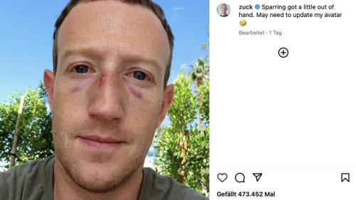 Blaue Flecken und eine Wunde: Mark Zuckerberg schockiert Fans mit Gesichtsverletzungen