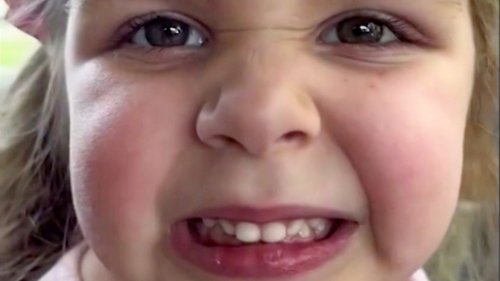 Vierjährige kann nicht lächeln – ein Grund zur Sorge? Kinderarzt erklärt das Phänomen