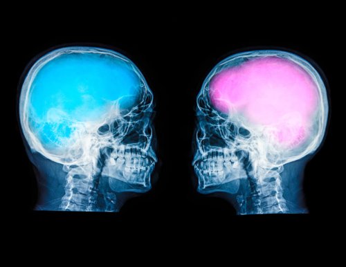 New research challenges idea that female, male brains 'wired' differently -- at least in childhood