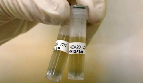 Covid-19 has been detected in wastewater — so what does that actually mean?