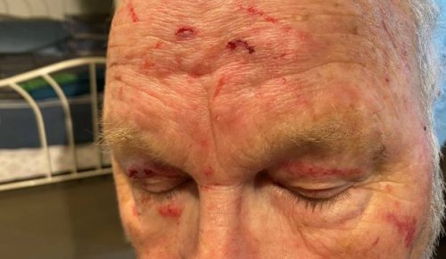 Bus driver who spoke out about his assault now 'gagged' by NZ Bus, he says