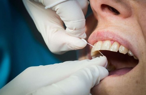 Zahnreport Baden-Württemberg: Wie gut sind die Zähne im Land?