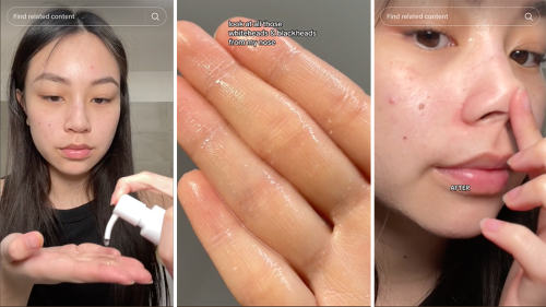 TikTok Is Hooked on This $18 Cleansing Oil That Removes Blackheads on the Spot