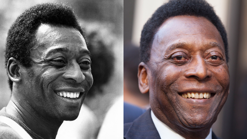 How Did Pelé Die? His Doctors Found a ‘Suspicious Lesion’ in His Body ...