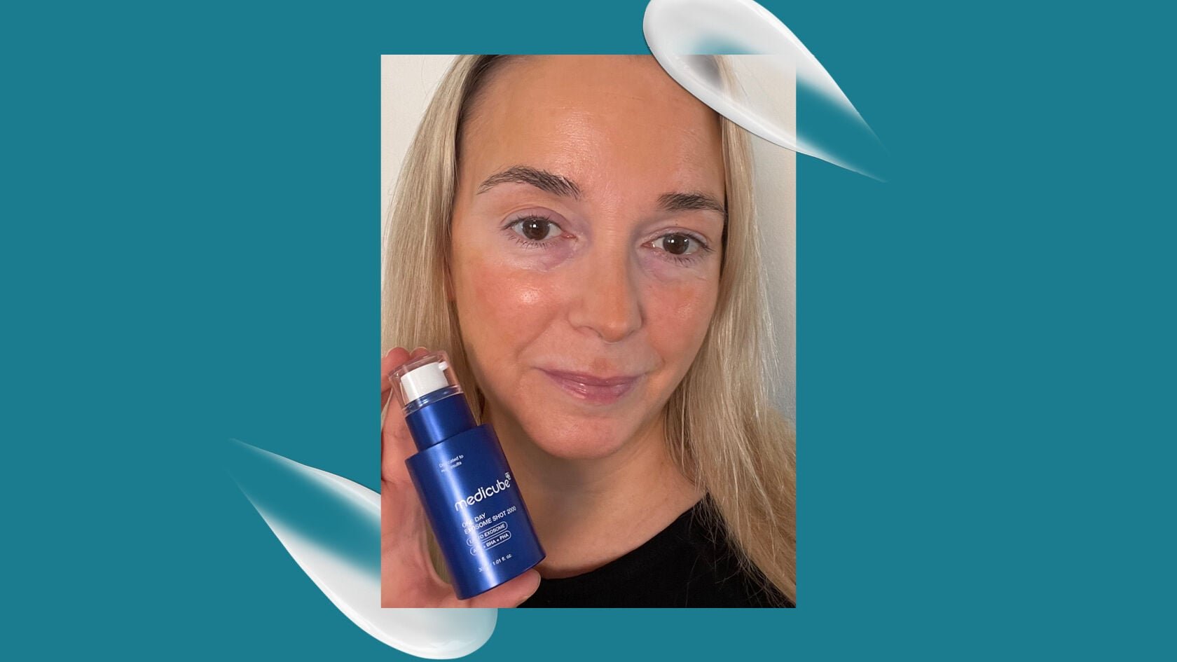 “I tried K-beauty’s liquid microneedling trend, and my skin’s glow is off the charts“