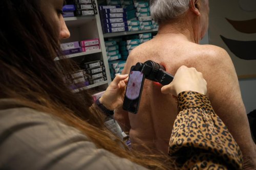 « Dans trois jours, on sera fixé », comment l’intelligence artificielle pallie le manque de dermatologues